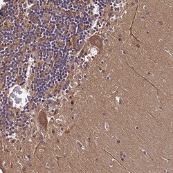 Invitrogen DOHH Polyclonal Antibody 100 &mu;L; Unconjugated:Antibodies,