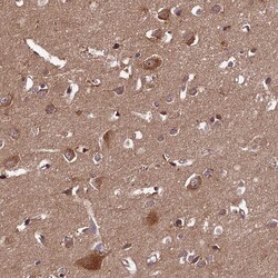 Invitrogen DOHH Polyclonal Antibody 100 &mu;L; Unconjugated:Antibodies,