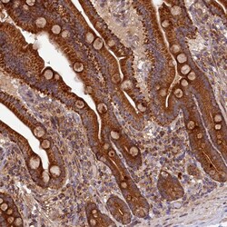 Invitrogen DOHH Polyclonal Antibody 100 &mu;L; Unconjugated:Antibodies,