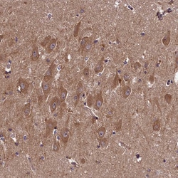 Invitrogen DOHH Polyclonal Antibody 100 &mu;L; Unconjugated:Antibodies,