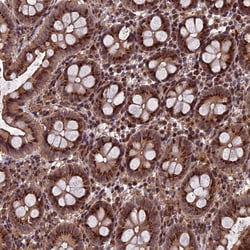 Invitrogen RASGRF1 Polyclonal Antibody 100 &mu;L; Unconjugated:Antibodies,