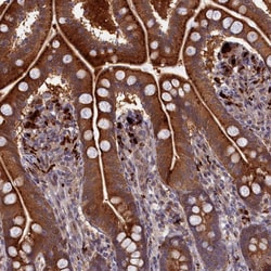 Invitrogen FUK Polyclonal Antibody 100 &mu;L; Unconjugated:Antibodies,