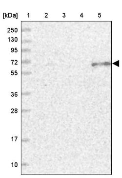 Invitrogen ETFDH Polyclonal Antibody 100 &mu;L; Unconjugated:Antibodies,