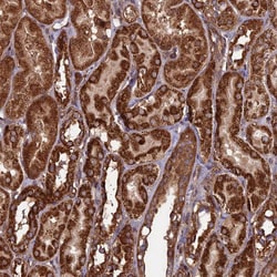 Invitrogen CCDC8 Polyclonal Antibody 100 &mu;L; Unconjugated:Antibodies,