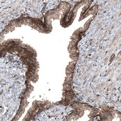 Invitrogen C19orf66 Polyclonal Antibody 100 &mu;L; Unconjugated:Antibodies,