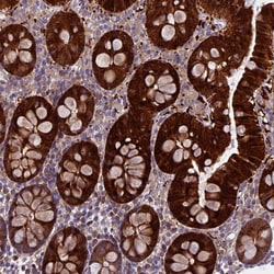 Invitrogen DCTN5 Polyclonal Antibody 100 &mu;L; Unconjugated:Antibodies,