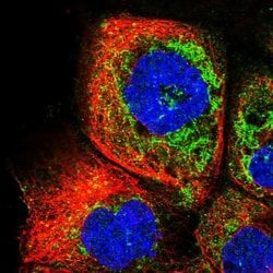 Invitrogen RDH13 Polyclonal Antibody 100 &mu;L; Unconjugated:Antibodies,