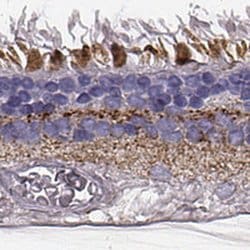 Invitrogen RDH13 Polyclonal Antibody 100 &mu;L; Unconjugated:Antibodies,