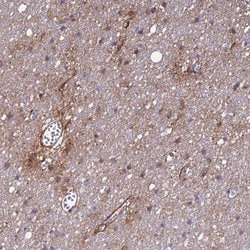 Invitrogen P2X7 Polyclonal Antibody 100 &mu;L; Unconjugated:Antibodies,