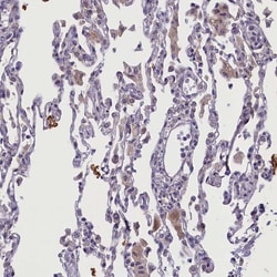 Invitrogen CCL23 Polyclonal Antibody 100 &mu;L; Unconjugated:Antibodies,