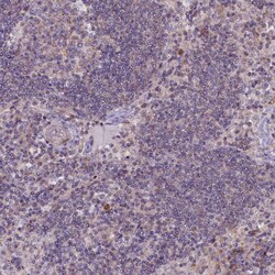 Invitrogen CCL23 Polyclonal Antibody 100 &mu;L; Unconjugated:Antibodies,