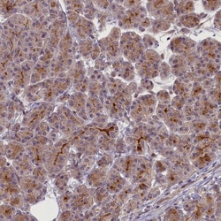 Invitrogen CCL23 Polyclonal Antibody 100 &mu;L; Unconjugated:Antibodies,