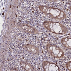 Invitrogen CCL23 Polyclonal Antibody 100 &mu;L; Unconjugated:Antibodies,