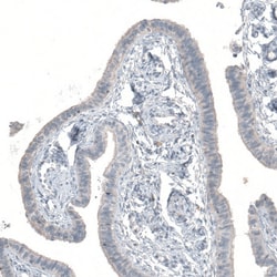 Invitrogen C15orf23 Polyclonal Antibody 100 &mu;L; Unconjugated:Antibodies,