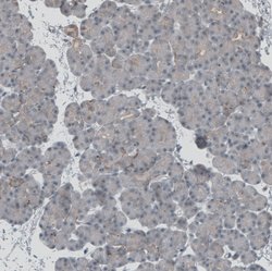 Invitrogen C15orf23 Polyclonal Antibody 100 &mu;L; Unconjugated:Antibodies,