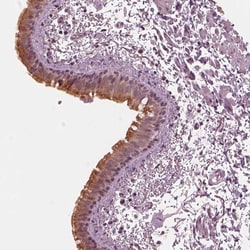Invitrogen IQCB1 Polyclonal Antibody 100 &mu;L; Unconjugated:Antibodies,
