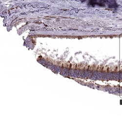 Invitrogen IQCB1 Polyclonal Antibody 100 &mu;L; Unconjugated:Antibodies,