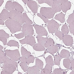 Invitrogen IQCB1 Polyclonal Antibody 100 &mu;L; Unconjugated:Antibodies,