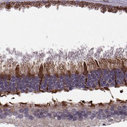 Invitrogen IQCB1 Polyclonal Antibody 100 &mu;L; Unconjugated:Antibodies,