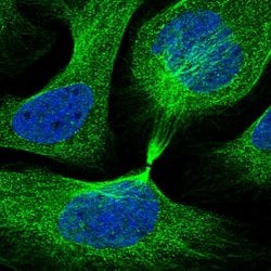 Invitrogen IQCB1 Polyclonal Antibody 100 &mu;L; Unconjugated:Antibodies,