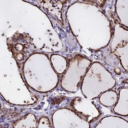 Invitrogen CHMP2A Polyclonal Antibody 100 &mu;L; Unconjugated:Antibodies,
