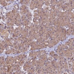 Invitrogen CHMP2A Polyclonal Antibody 100 &mu;L; Unconjugated:Antibodies,