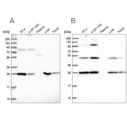 Invitrogen PGLS Polyclonal Antibody 100 &mu;L; Unconjugated:Antibodies,