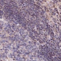 Invitrogen TMC5 Polyclonal Antibody 100 &mu;L; Unconjugated:Antibodies,