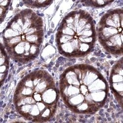 Invitrogen TMC5 Polyclonal Antibody 100 &mu;L; Unconjugated:Antibodies,