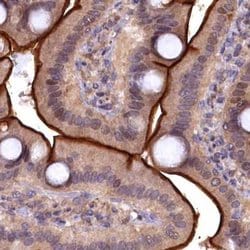 Invitrogen TMC5 Polyclonal Antibody 100 &mu;L; Unconjugated:Antibodies,