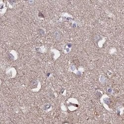 Invitrogen TMC5 Polyclonal Antibody 100 &mu;L; Unconjugated:Antibodies,