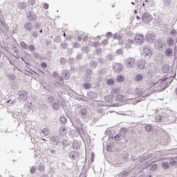 Invitrogen Filensin Polyclonal Antibody 100 &mu;L; Unconjugated:Antibodies,
