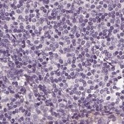 Invitrogen Filensin Polyclonal Antibody 100 &mu;L; Unconjugated:Antibodies,