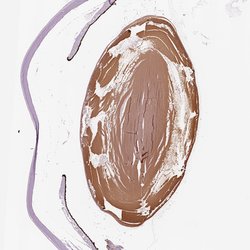 Invitrogen Filensin Polyclonal Antibody 100 &mu;L; Unconjugated:Antibodies,