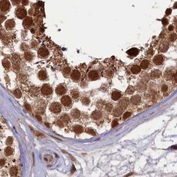 Invitrogen NAE1 Polyclonal Antibody 100 &mu;L; Unconjugated:Antibodies,
