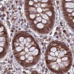 Invitrogen NAE1 Polyclonal Antibody 100 &mu;L; Unconjugated:Antibodies,