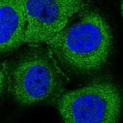 Invitrogen MYO9B Polyclonal Antibody 100 &mu;L; Unconjugated:Antibodies,