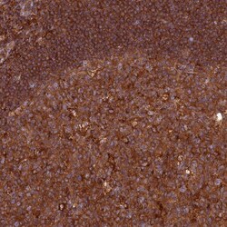 Invitrogen MYO9B Polyclonal Antibody 100 &mu;L; Unconjugated:Antibodies,