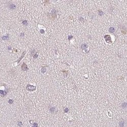 Invitrogen TREH Polyclonal Antibody 100 &mu;L; Unconjugated:Anticuerpos