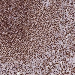 Invitrogen SNRNP70 Polyclonal Antibody 100 &mu;L | Buy Online | Invitrogen&trade; | Fisher Scientific