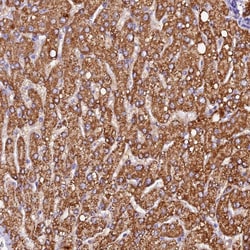 Invitrogen SIX5 Polyclonal Antibody 100 &mu;L; Unconjugated:Antibodies,