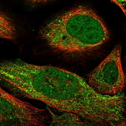 Invitrogen CARD8 Polyclonal Antibody 100 &mu;L; Unconjugated:Antibodies,