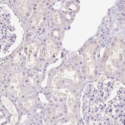 Invitrogen SYCE2 Polyclonal Antibody 100 &mu;L; Unconjugated:Antibodies,