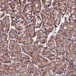 Invitrogen ZNF749 Polyclonal Antibody 100 &mu;L; Unconjugated:Antibodies,