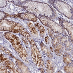 Invitrogen ZSWIM4 Polyclonal Antibody 100 &mu;L; Unconjugated:Antibodies,