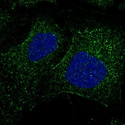 Invitrogen FBXW9 Polyclonal Antibody 100 &mu;L; Unconjugated:Antibodies,
