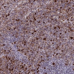Invitrogen APOB48R Polyclonal Antibody 100 &mu;L | Buy Online | Invitrogen&trade; | Fisher Scientific