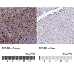 Invitrogen APOB48R Polyclonal Antibody 100 &mu;L | Buy Online | Invitrogen&trade; | Fisher Scientific