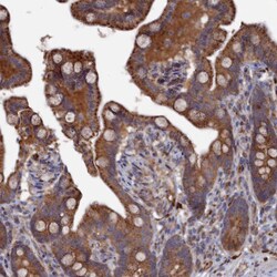 Invitrogen C19orf61 Polyclonal Antibody 100 &mu;L; Unconjugated:Antibodies,