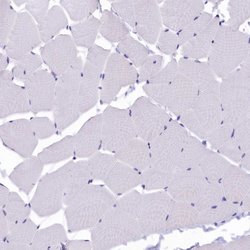 Invitrogen SOD3 Polyclonal Antibody 100 &mu;L; Unconjugated:Antibodies,